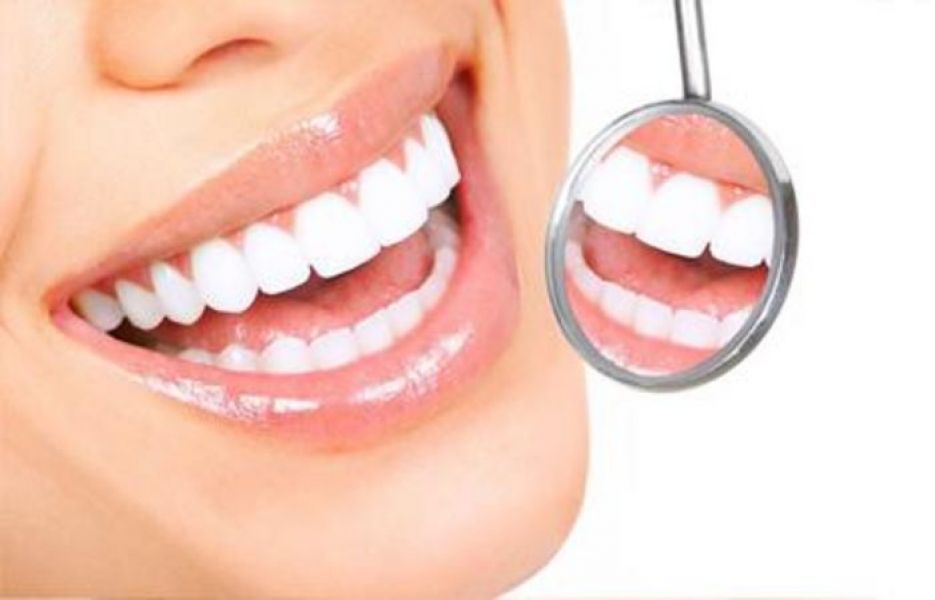 Dental Bonding – White Fillings & Dental Teeth Bonding