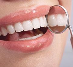 Cleaning (Scaling) Teeth & Maintenance – Gum Disease Treatment 