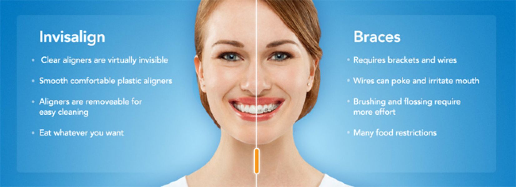 Invisalign Braces - Invisalign Orthodontics Treatment Blackburn | Healthy Smiles 