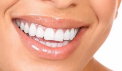 Have a dazzling smile with teeth whitening treatment