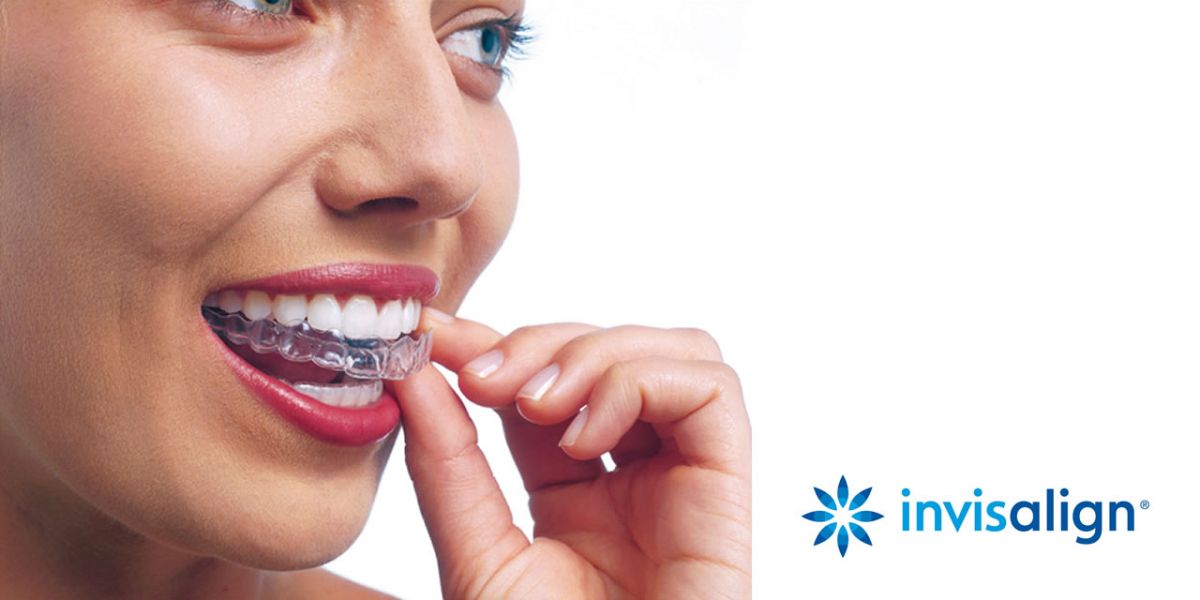 Invisalign Braces - Invisalign Orthodontics Treatment Blackburn | Healthy Smiles 