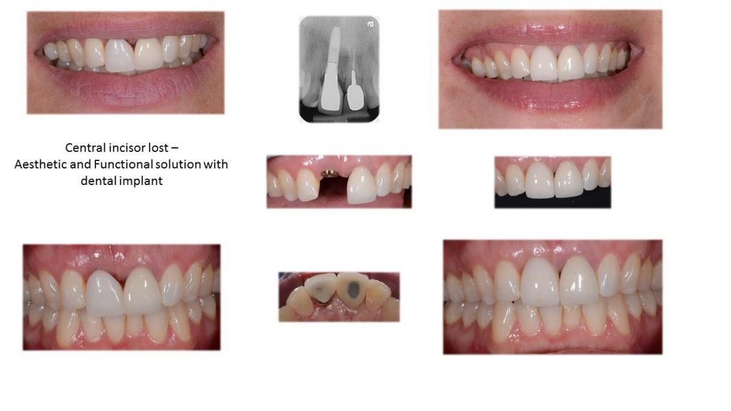 Making Your Dental Visit a Pleasant Visit at Ashton Avenue Dental Clinic Practice