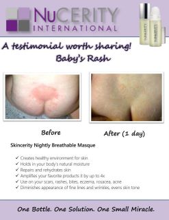 Healthy, Smoother, Younger Skin Without Medical Intervention