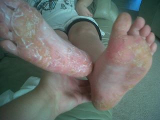 Healthy, Smoother, Younger Skin Without Medical Intervention